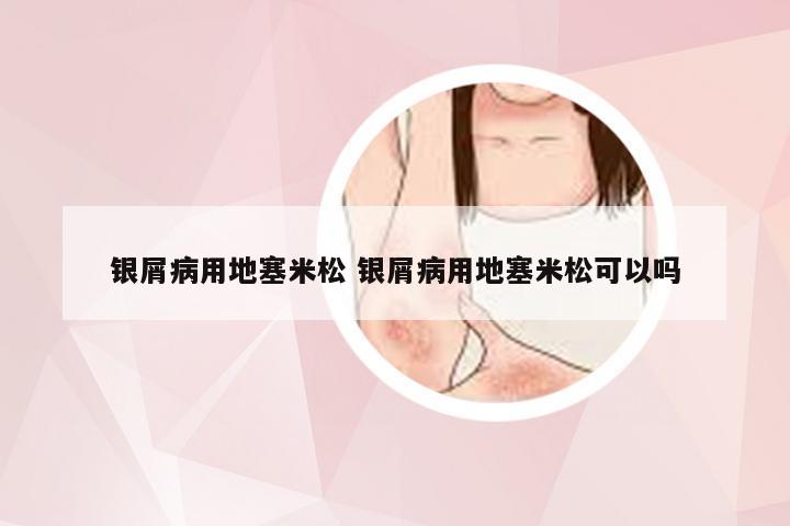 银屑病用地塞米松 银屑病用地塞米松可以吗