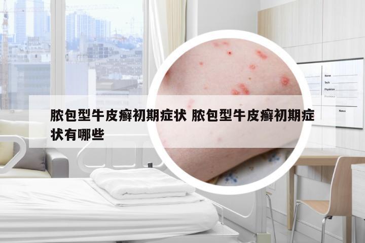 脓包型牛皮癣初期症状 脓包型牛皮癣初期症状有哪些