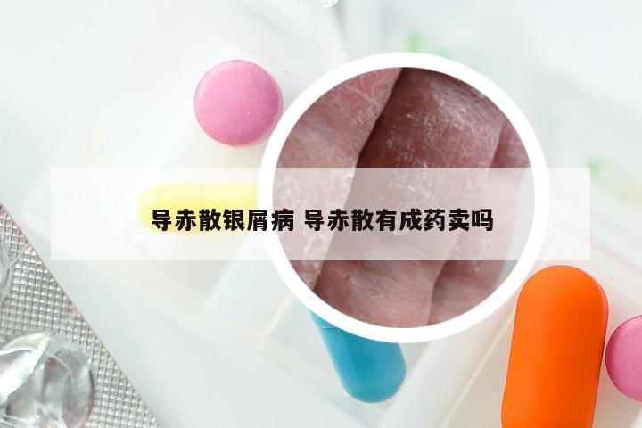 导赤散银屑病 导赤散有成药卖吗