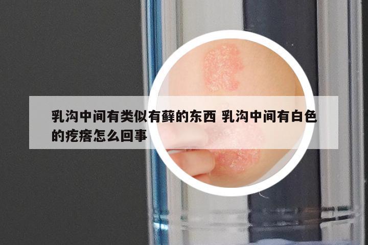 乳沟中间有类似有藓的东西 乳沟中间有白色的疙瘩怎么回事