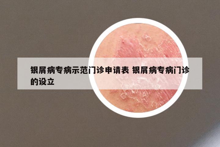 银屑病专病示范门诊申请表 银屑病专病门诊的设立