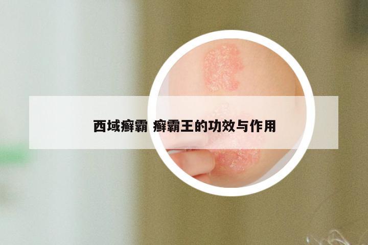 西域癣霸 癣霸王的功效与作用