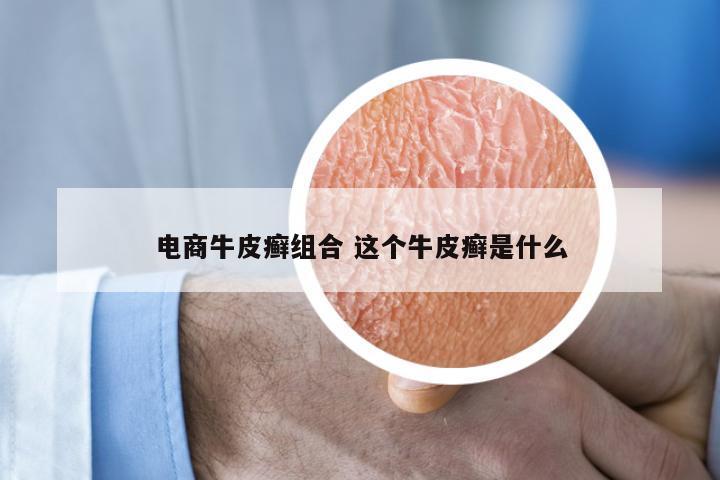 电商牛皮癣组合 这个牛皮癣是什么