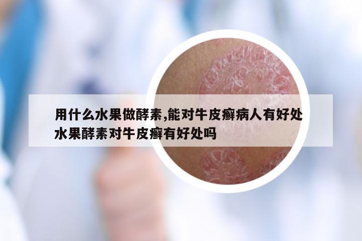 用什么水果做酵素,能对牛皮癣病人有好处 水果酵素对牛皮癣有好处吗