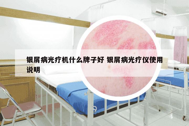 银屑病光疗机什么牌子好 银屑病光疗仪使用说明