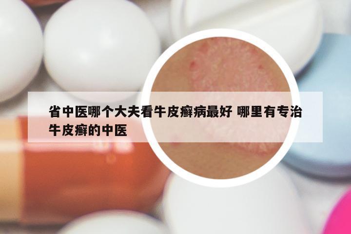 省中医哪个大夫看牛皮癣病最好 哪里有专治牛皮癣的中医