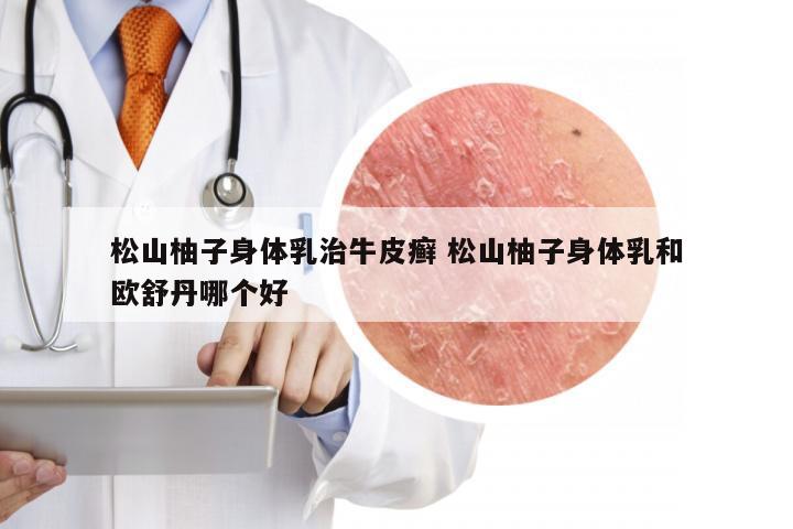 松山柚子身体乳治牛皮癣 松山柚子身体乳和欧舒丹哪个好