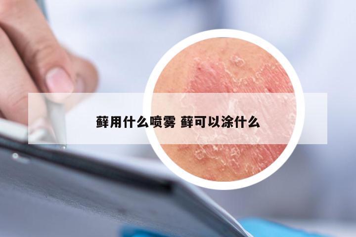 藓用什么喷雾 藓可以涂什么