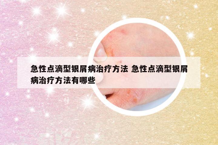急性点滴型银屑病治疗方法 急性点滴型银屑病治疗方法有哪些