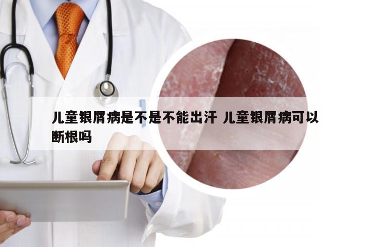 儿童银屑病是不是不能出汗 儿童银屑病可以断根吗
