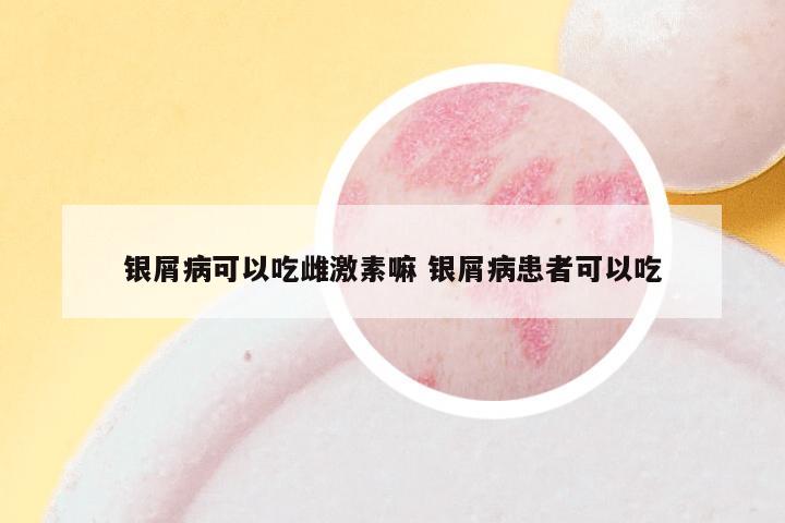 银屑病可以吃雌激素嘛 银屑病患者可以吃