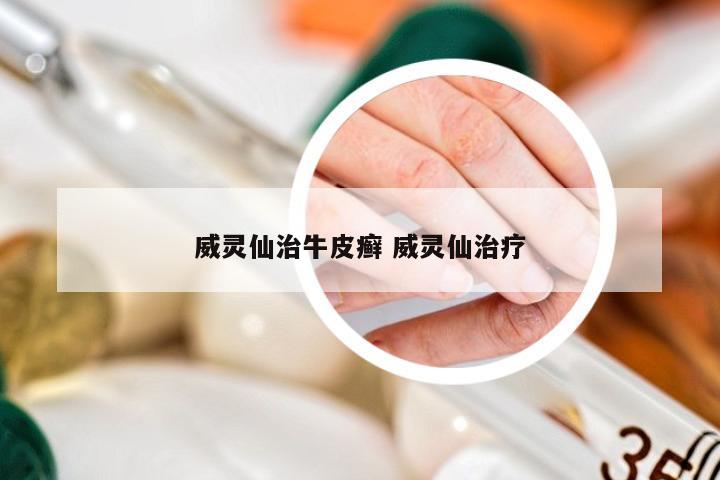 威灵仙治牛皮癣 威灵仙治疗
