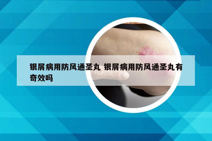 银屑病用防风通圣丸 银屑病用防风通圣丸有奇效吗