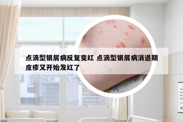点滴型银屑病反复变红 点滴型银屑病消退期皮疹又开始发红了