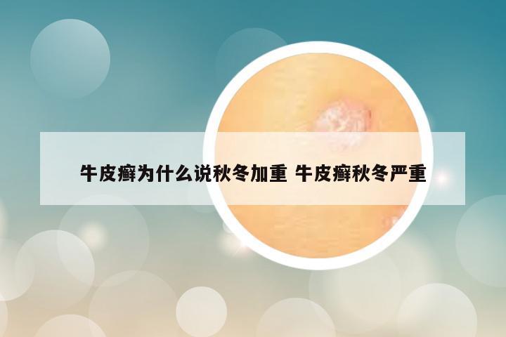 牛皮癣为什么说秋冬加重 牛皮癣秋冬严重