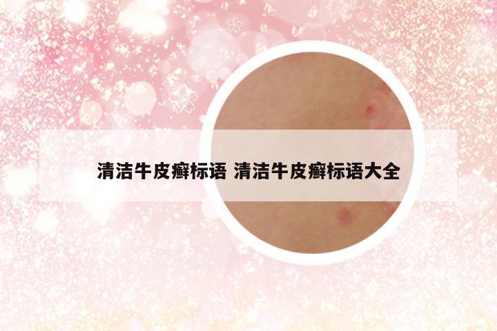 清洁牛皮癣标语 清洁牛皮癣标语大全