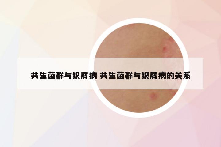 共生菌群与银屑病 共生菌群与银屑病的关系