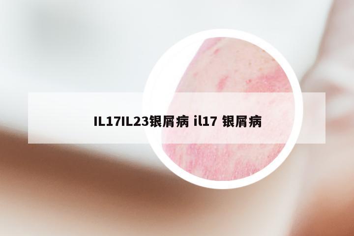 IL17IL23银屑病 il17 银屑病