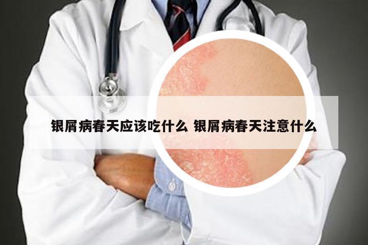 银屑病春天应该吃什么 银屑病春天注意什么