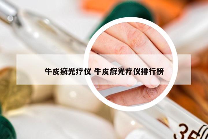 牛皮癣光疗仪 牛皮癣光疗仪排行榜
