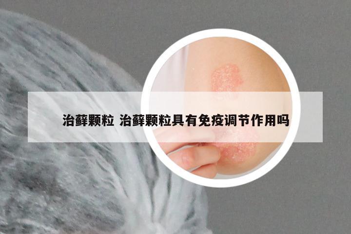 治藓颗粒 治藓颗粒具有免疫调节作用吗