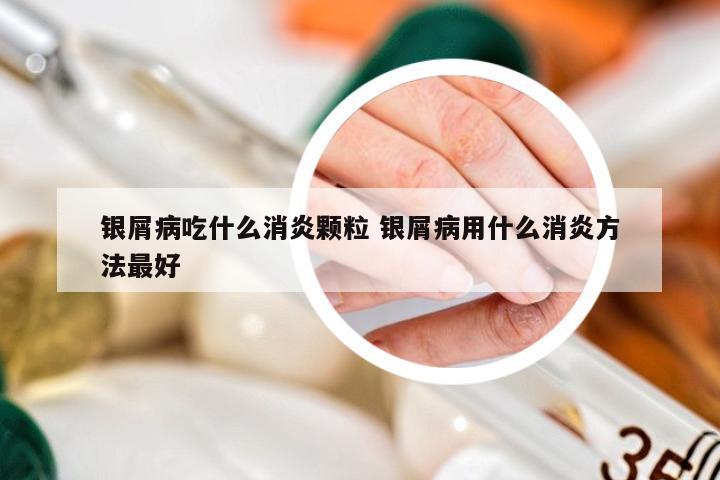 银屑病吃什么消炎颗粒 银屑病用什么消炎方法最好