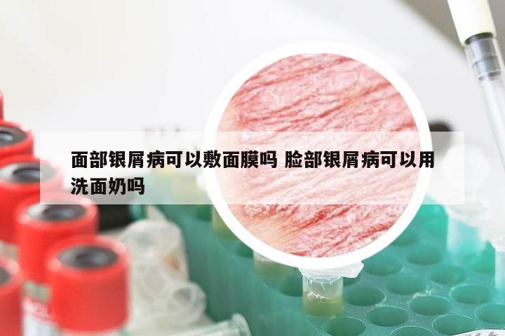 面部银屑病可以敷面膜吗 脸部银屑病可以用洗面奶吗