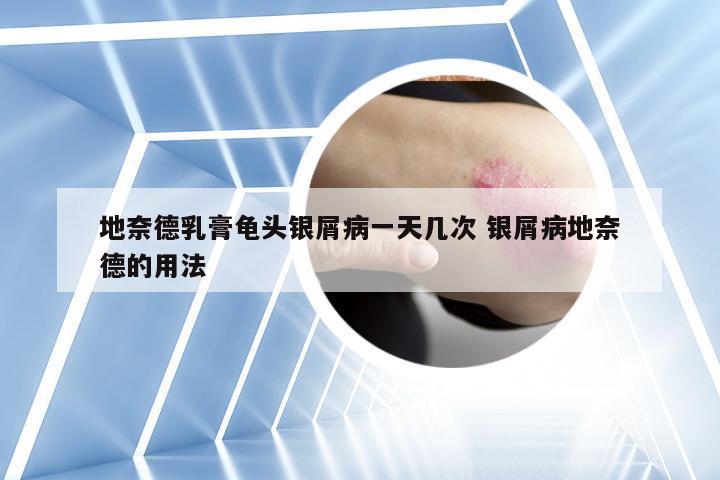 地奈德乳膏龟头银屑病一天几次 银屑病地奈德的用法