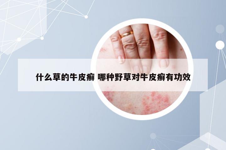 什么草的牛皮癣 哪种野草对牛皮癣有功效