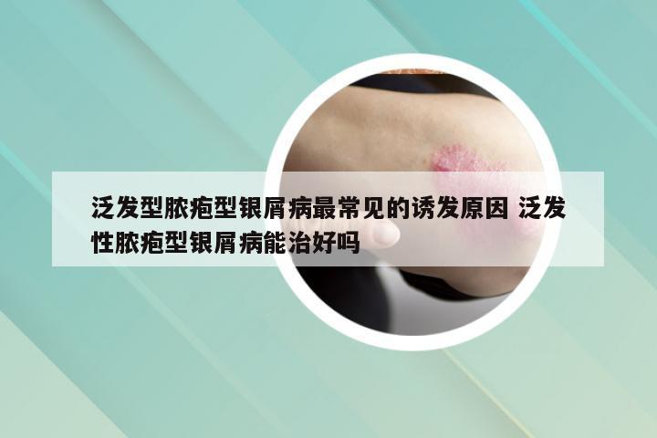 泛发型脓疱型银屑病最常见的诱发原因 泛发性脓疱型银屑病能治好吗