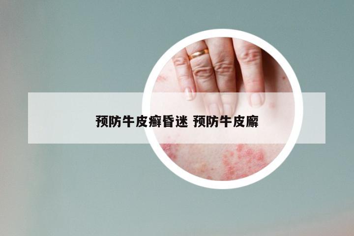 预防牛皮癣昏迷 预防牛皮廨