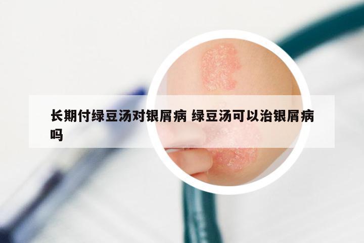 长期付绿豆汤对银屑病 绿豆汤可以治银屑病吗