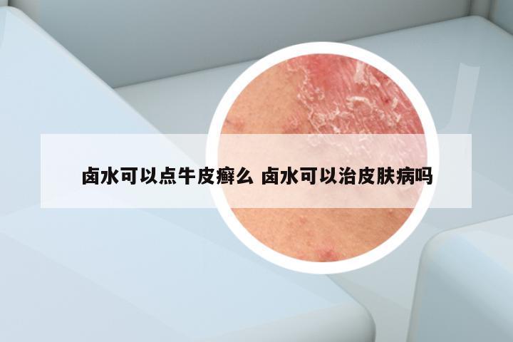 卤水可以点牛皮癣么 卤水可以治皮肤病吗