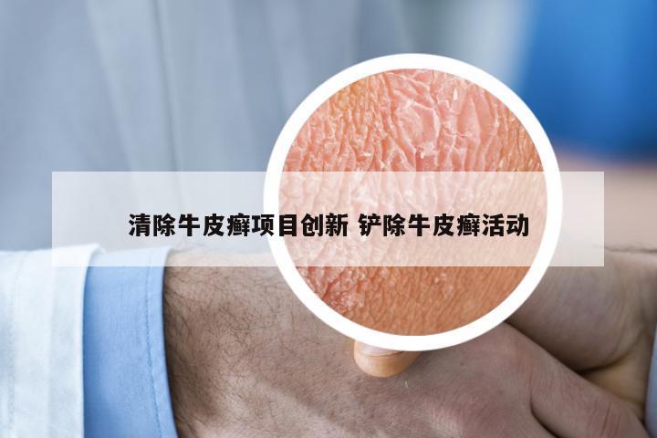 清除牛皮癣项目创新 铲除牛皮癣活动