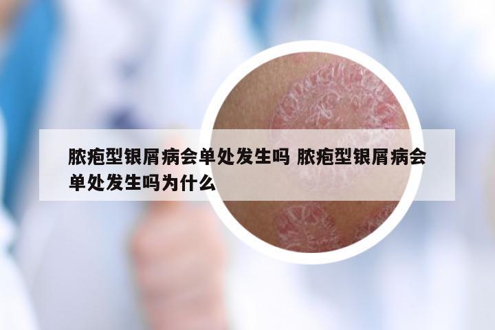 脓疱型银屑病会单处发生吗 脓疱型银屑病会单处发生吗为什么
