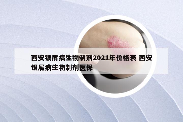 西安银屑病生物制剂2021年价格表 西安银屑病生物制剂医保