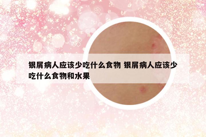 银屑病人应该少吃什么食物 银屑病人应该少吃什么食物和水果