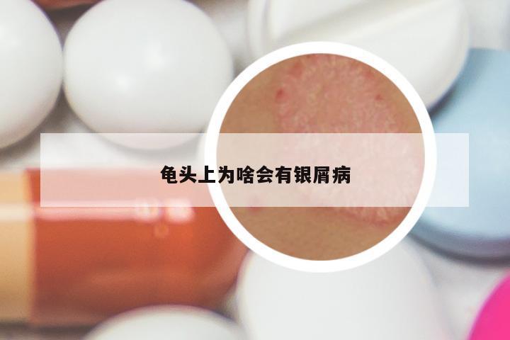 龟头上为啥会有银屑病
