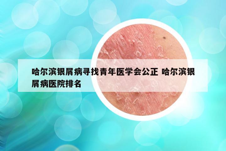 哈尔滨银屑病寻找青年医学会公正 哈尔滨银屑病医院排名