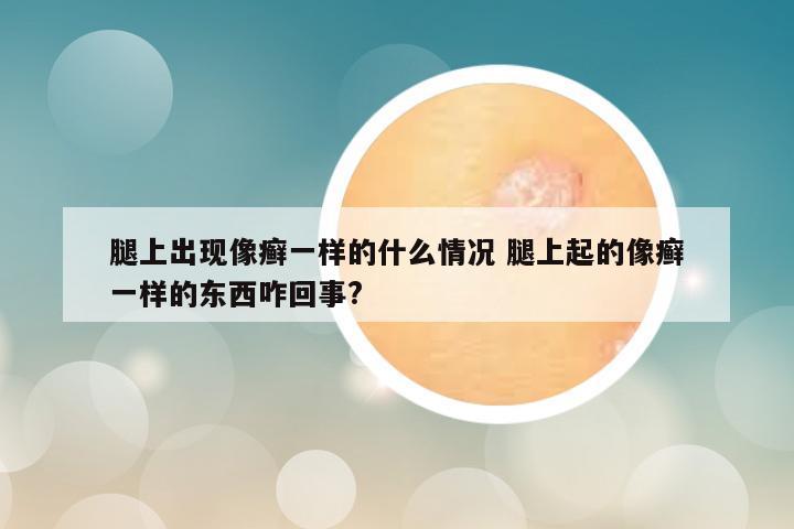 腿上出现像癣一样的什么情况 腿上起的像癣一样的东西咋回事?