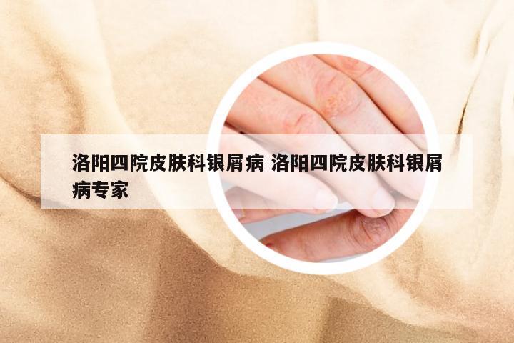 洛阳四院皮肤科银屑病 洛阳四院皮肤科银屑病专家