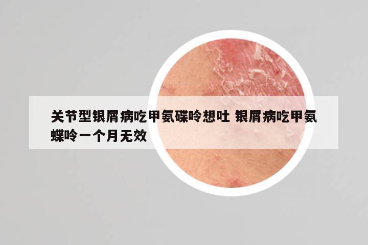 关节型银屑病吃甲氨碟呤想吐 银屑病吃甲氨蝶呤一个月无效