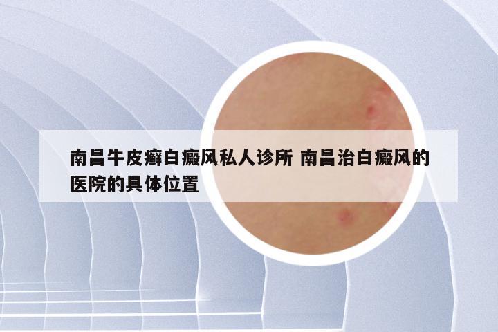 南昌牛皮癣白癜风私人诊所 南昌治白癜风的医院的具体位置