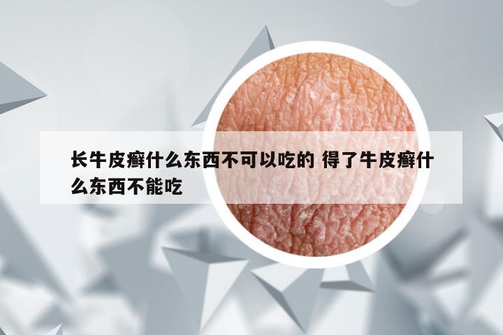 长牛皮癣什么东西不可以吃的 得了牛皮癣什么东西不能吃