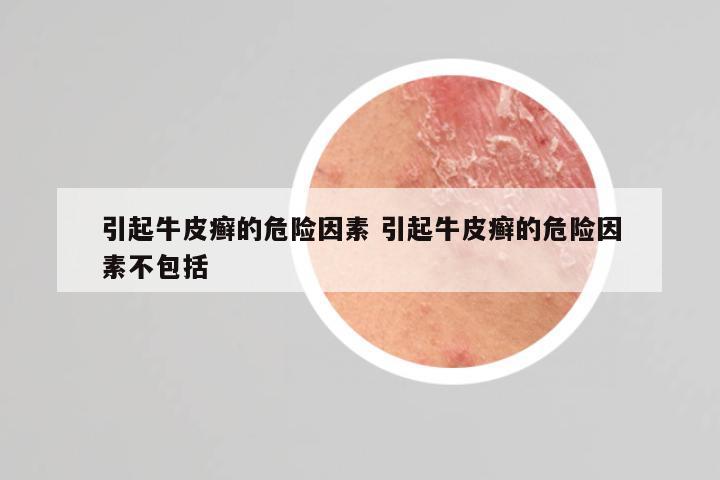引起牛皮癣的危险因素 引起牛皮癣的危险因素不包括