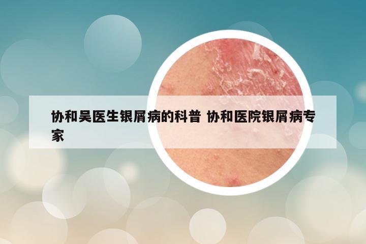 协和吴医生银屑病的科普 协和医院银屑病专家