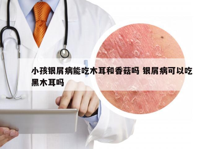 小孩银屑病能吃木耳和香菇吗 银屑病可以吃黑木耳吗