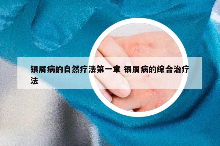 银屑病的自然疗法第一章 银屑病的综合治疗法