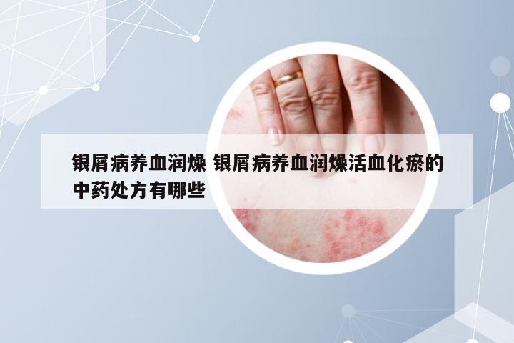 银屑病养血润燥 银屑病养血润燥活血化瘀的中药处方有哪些