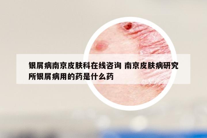 银屑病南京皮肤科在线咨询 南京皮肤病研究所银屑病用的药是什么药